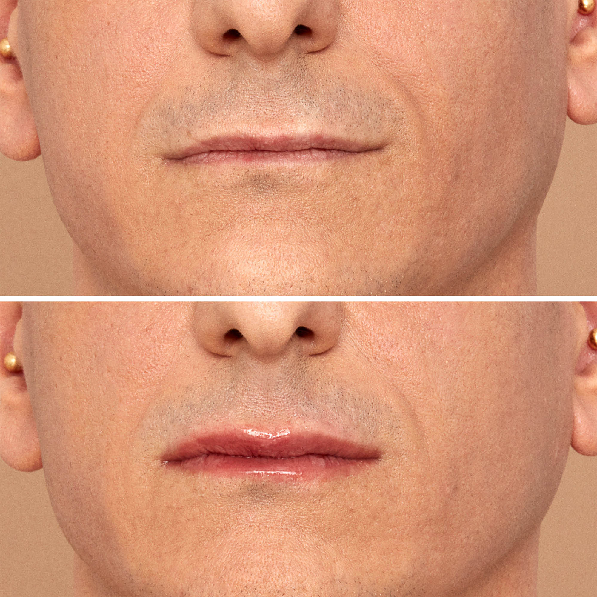 Viper Lip Plumper - Image 5